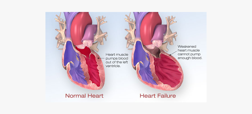 Normal Heart, Heart Muscle Pumps Blood Out Of The Left, HD Png Download, Free Download
