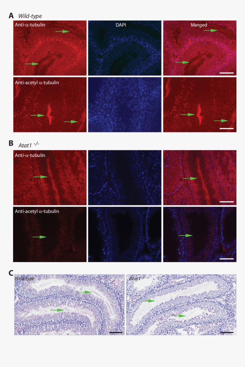 Acetylated Tubulin Drosophila Testis, HD Png Download, Free Download