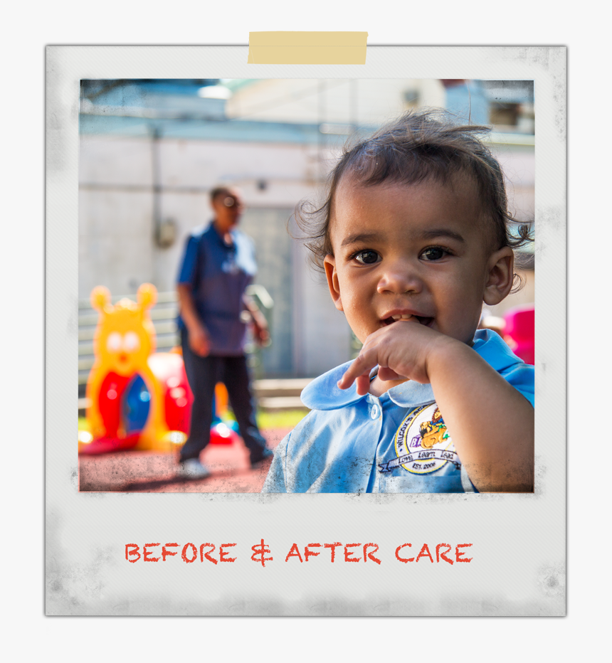 Wael Before After Care Img - Toddler, HD Png Download, Free Download