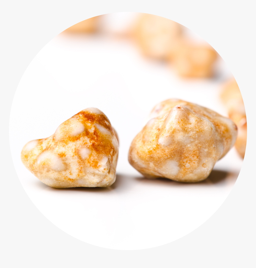Gallbladder Stones, HD Png Download, Free Download