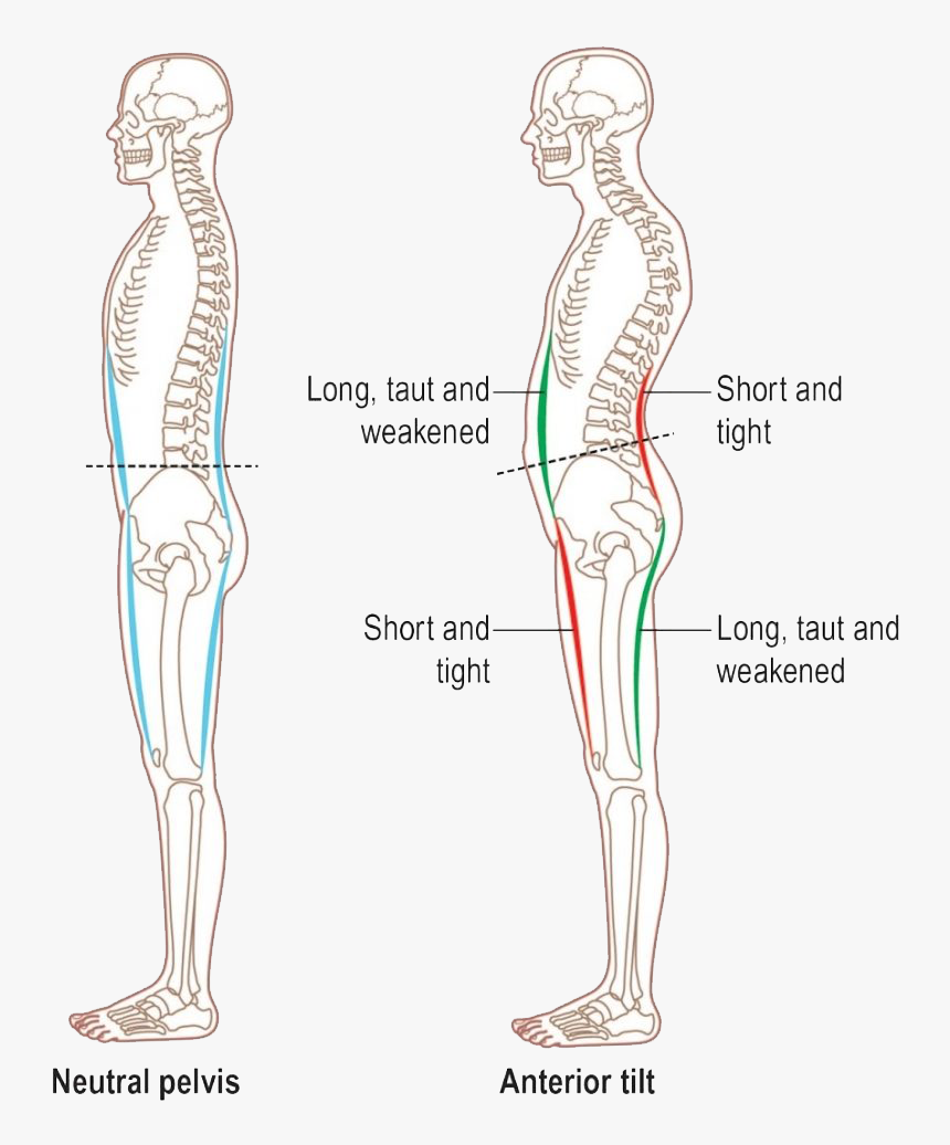 Picture Showing How A Calisthenics Workout Can Help - Illustration, HD Png Download, Free Download