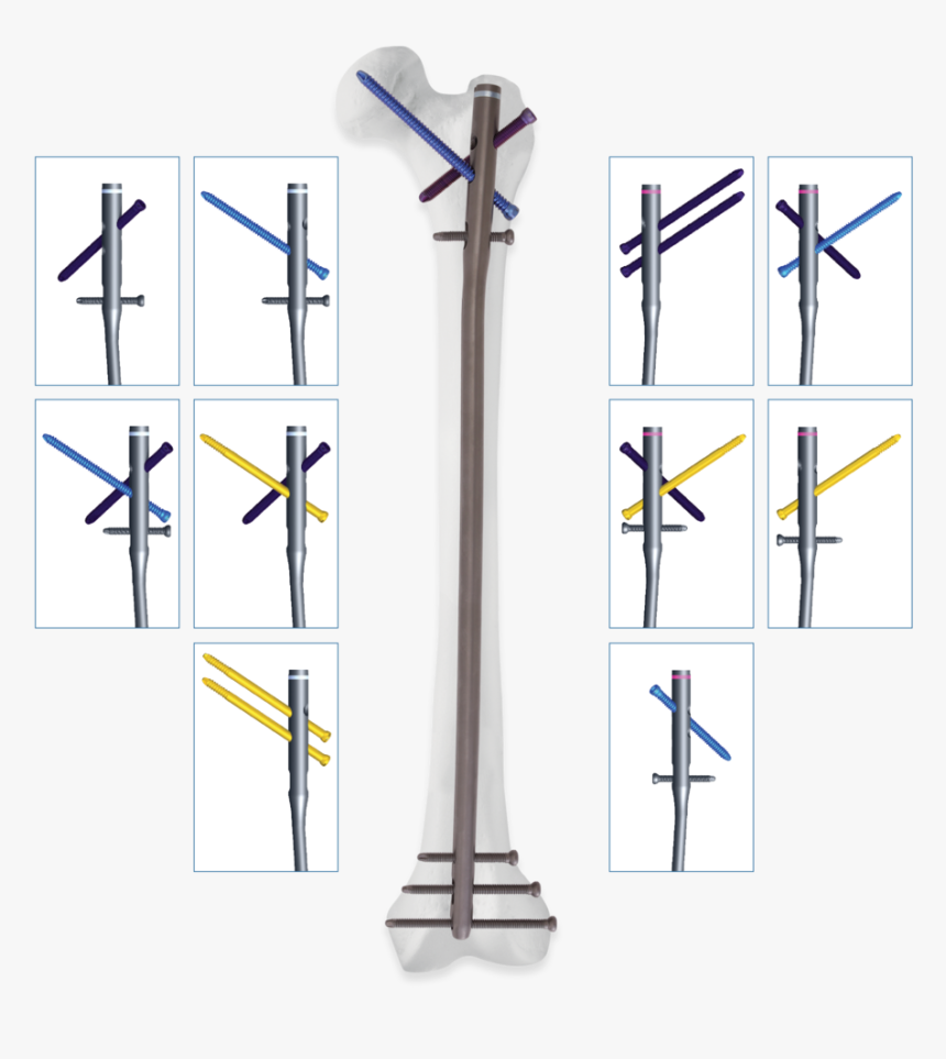 Mag-antegrade, HD Png Download, Free Download