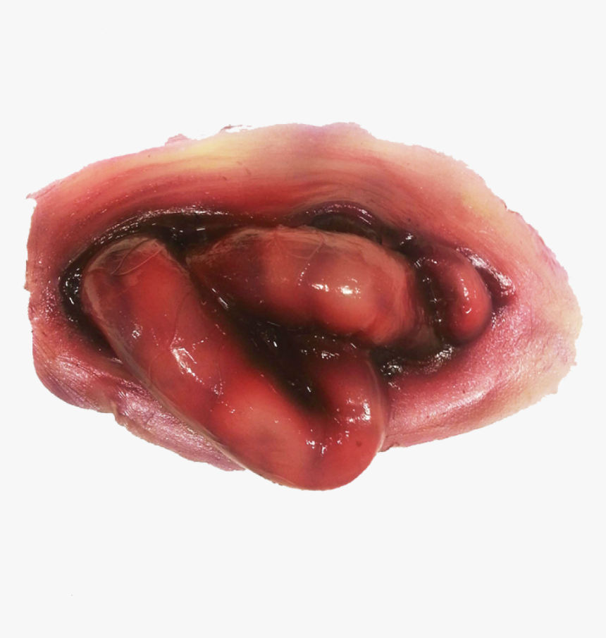 Sfx Hemorrhaging Intestine - Fruit, HD Png Download, Free Download