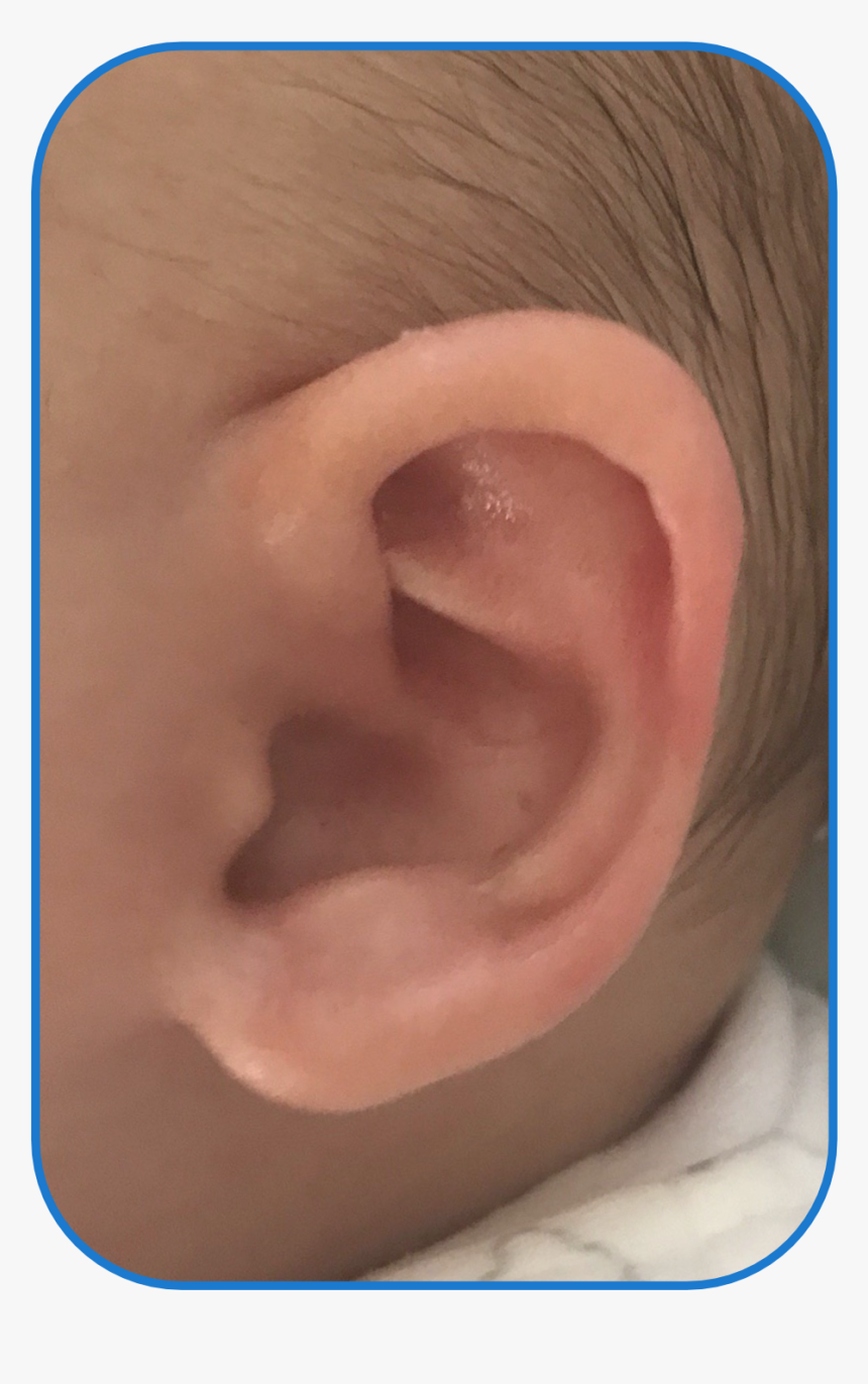 Ear Buddies Parent Review - Flesh, HD Png Download, Free Download