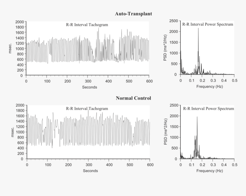 Heart Rhythms Generated By A Transplanted Heart At - Poster, HD Png Download, Free Download