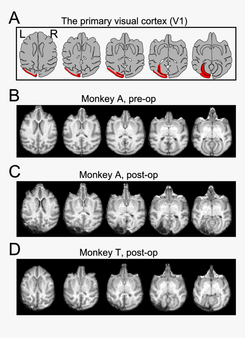 Visual Cortex Primate Horizontal Section, HD Png Download, Free Download