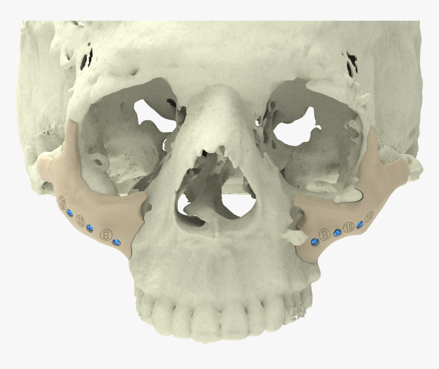 Xilloc Medical B - Skull, HD Png Download, Free Download