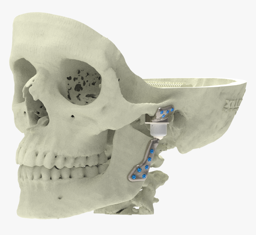 Xilloc Medical B - Skull, HD Png Download, Free Download