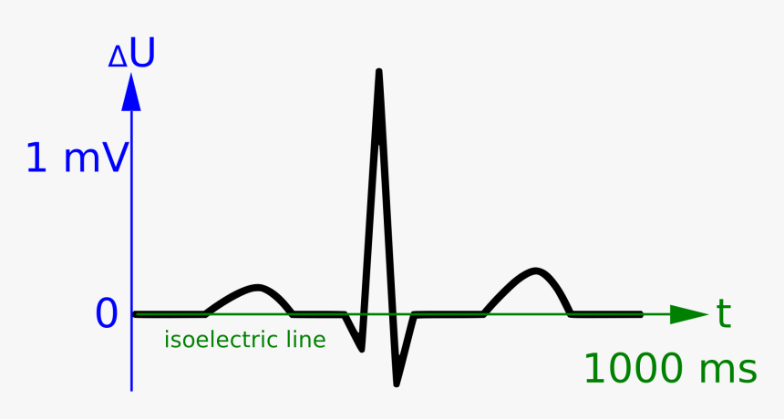 Picture Free Library File Curve Scales Wikimedia Commons - Ekg, HD Png Download, Free Download