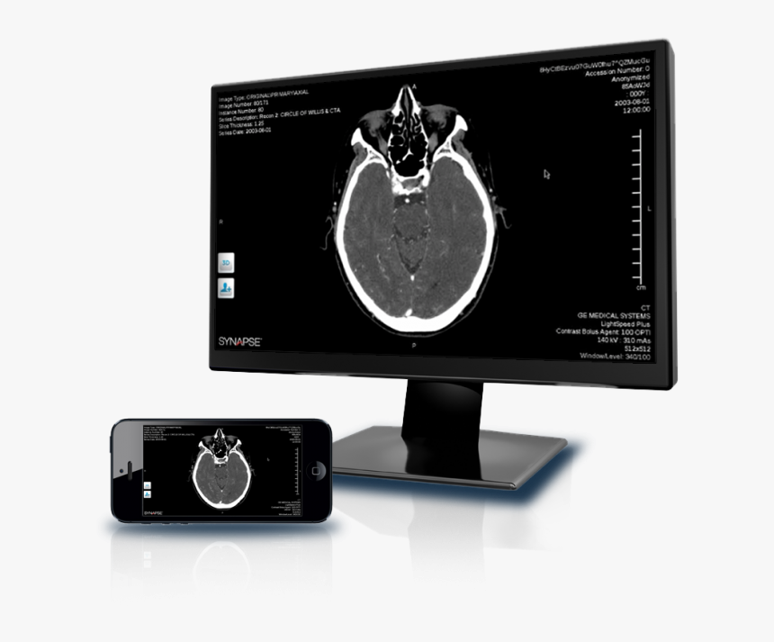 Synapse Mobility - Computer Monitor, HD Png Download, Free Download