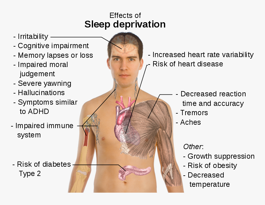 Sleep Deprevation, HD Png Download, Free Download