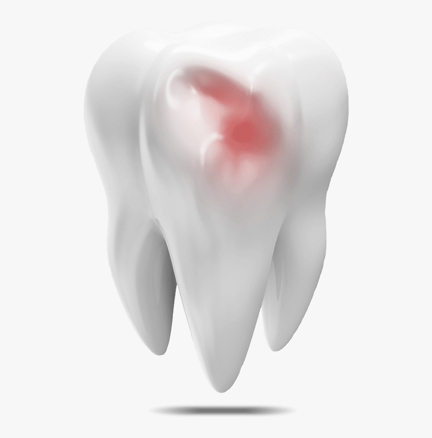 Damaged Tooth Model - Fang, HD Png Download, Free Download