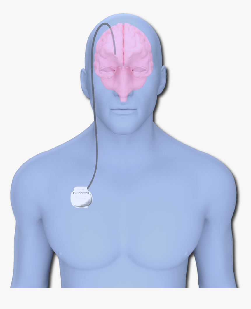 Alex Dbs System - Bust, HD Png Download, Free Download