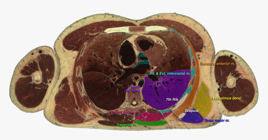 Vhm Triangle Of Auscultation Cs - Visible Human Project Heart, HD Png Download, Free Download