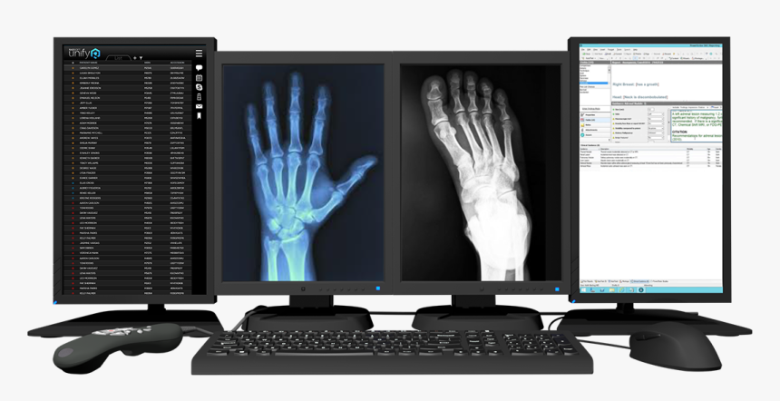 Radsoft-workstation - Radiologist Workstation, HD Png Download, Free Download