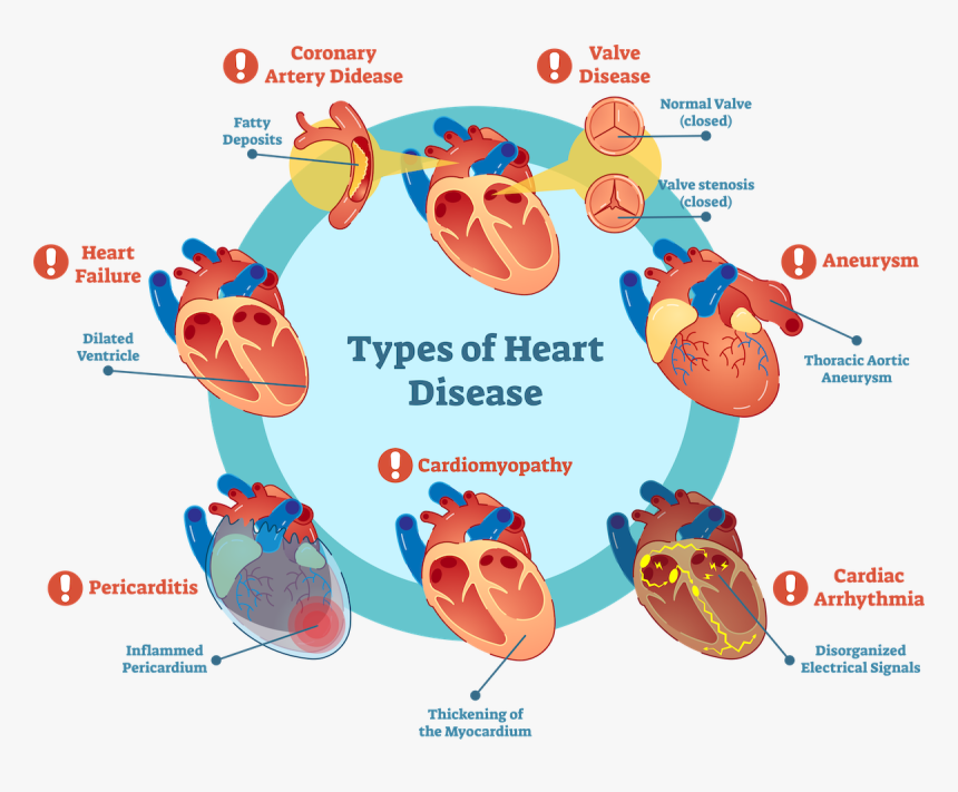Types Of Heart Disease Graphic - Heart Disease Diagram, HD Png Download, Free Download