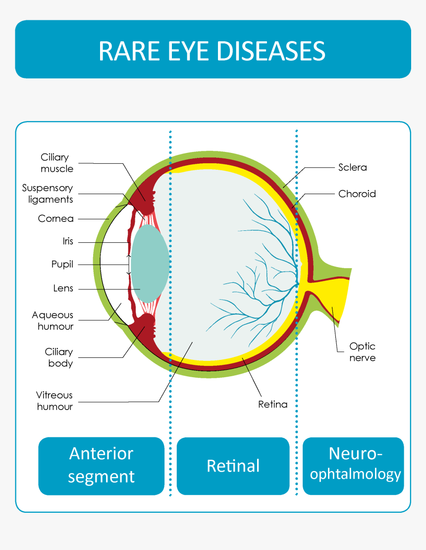 Rare Eye Diseases - Diseases Of Anterior Segment Of The Eye, HD Png Download, Free Download