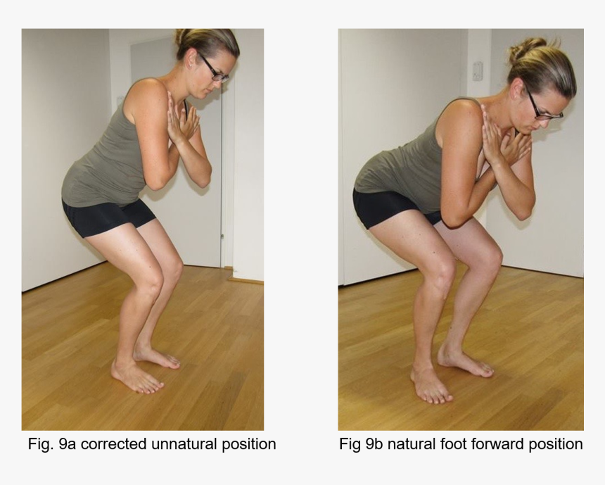 Fig 9a Corrected Unnatural Position Fig 9b Natural - Girl, HD Png Download, Free Download