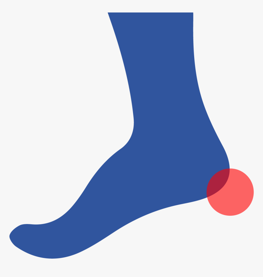 A Heel Spur Is A Calcium Deposit That Forms A Small - Sock, HD Png Download, Free Download