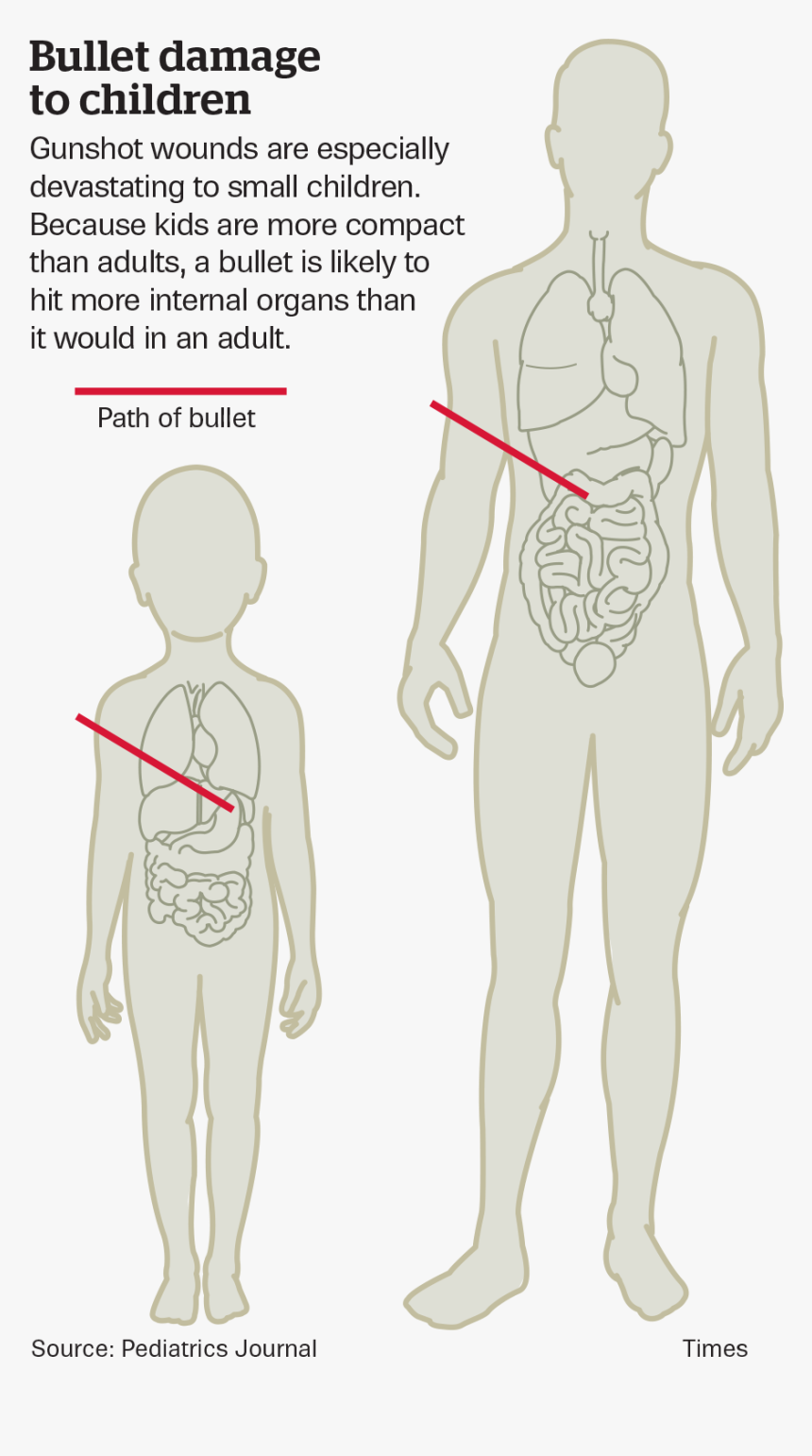 Children With Gunshot Wounds , Png Download - Shoulder Gunshot Scar, Transparent Png, Free Download