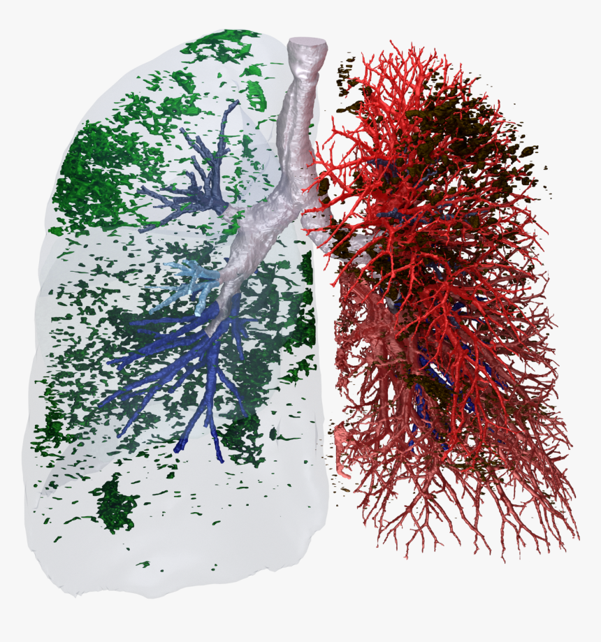 Transparent Blood Vessels Png - Idiopathic Pulmonary Fibrosis, Png Download, Free Download