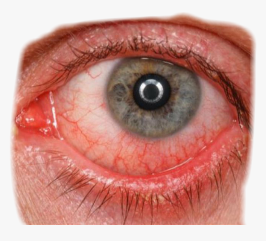 Eye Redeye Bloodshot Bloodshoteye Eyes Red - Bloodshot Eyes Png, Transparent Png, Free Download