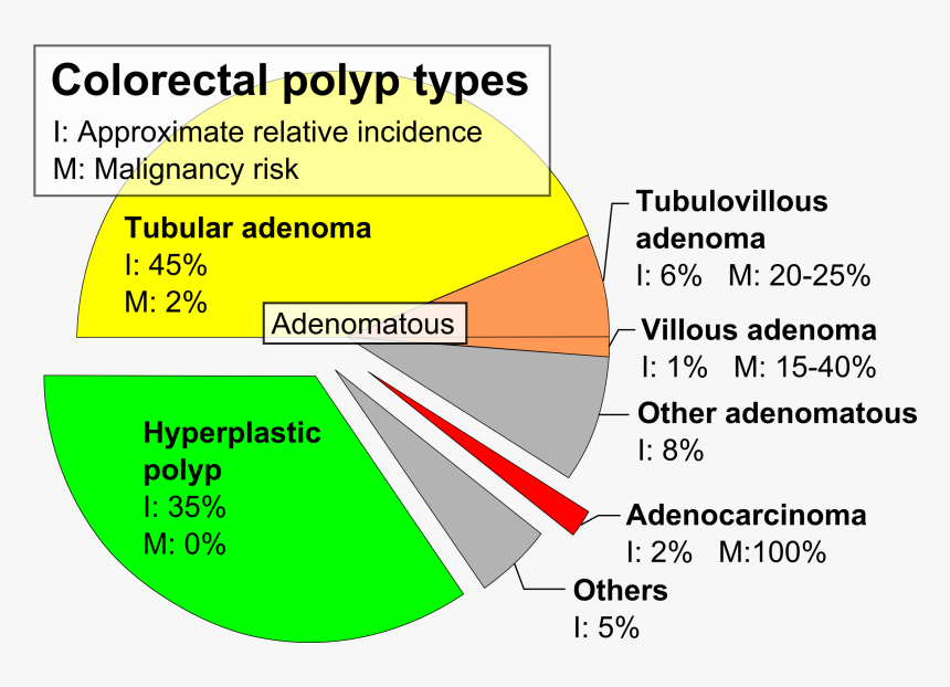 Pie Chart Of Colorectal Polyp Etiologies, HD Png Download, Free Download