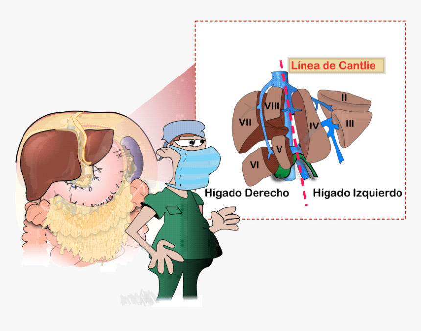 Linea De Cantlie Higado, HD Png Download, Free Download