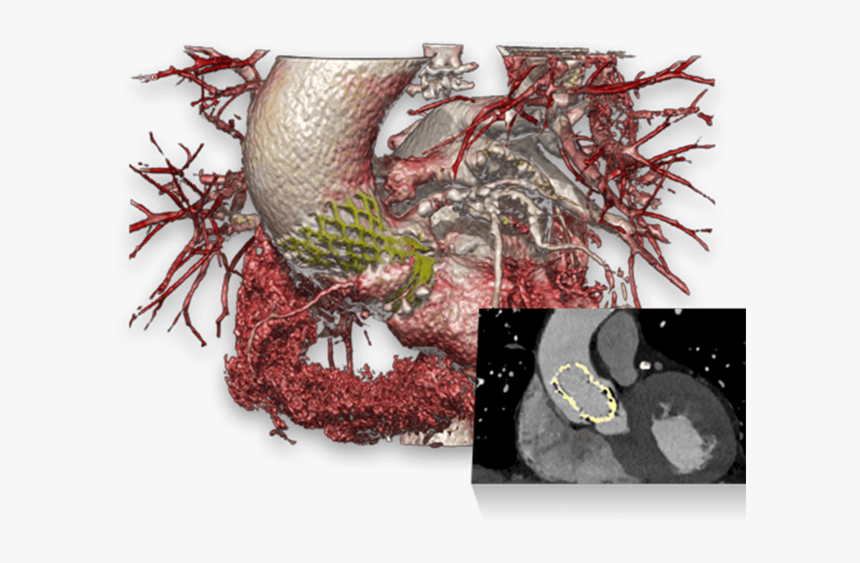 Dicom To Print Software For Development Of 3d Data - Graphic Design, HD Png Download, Free Download