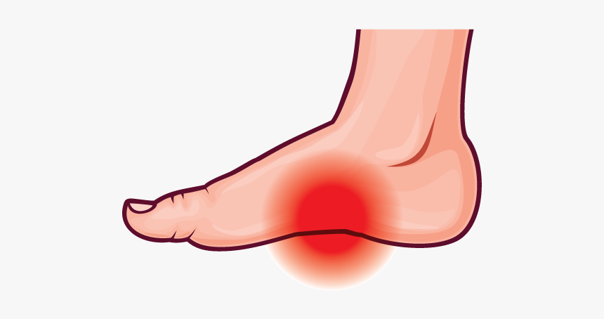 Arch Pain - Foot Pain Clipart, HD Png Download, Free Download