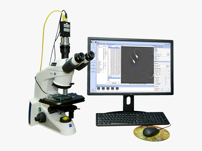 Photo Ceros Ii - Computer Assisted Semen Analysis Casa, HD Png Download, Free Download