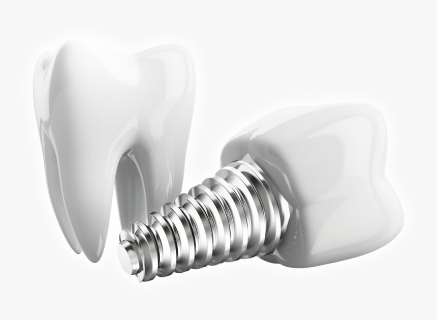 Dental Implant, HD Png Download, Free Download