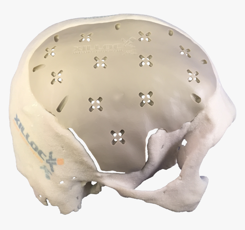 Side Pmma - Skull, HD Png Download, Free Download