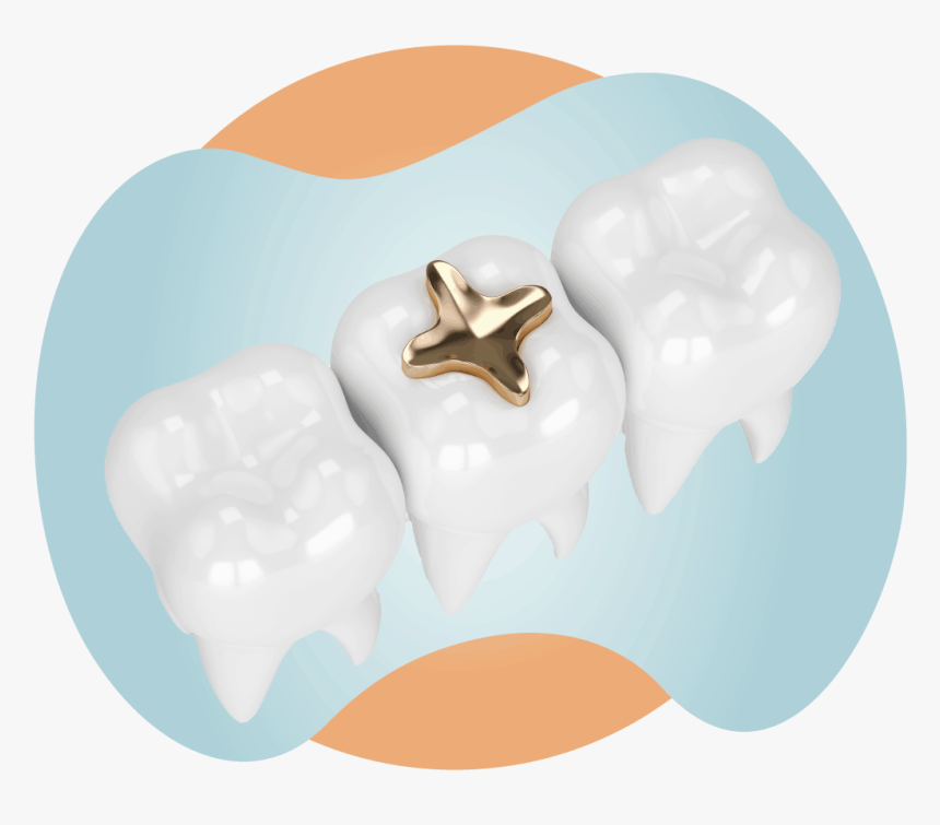 Three Teeth And One Molar With A Gold Dental Inlay - Icing, HD Png Download, Free Download