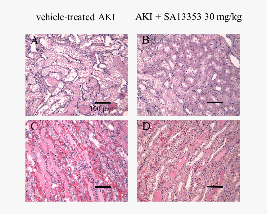 Marble, HD Png Download, Free Download