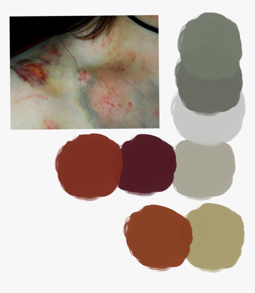 Bruise Transparent Fake - Bruise Drawing Reference, HD Png Download, Free Download
