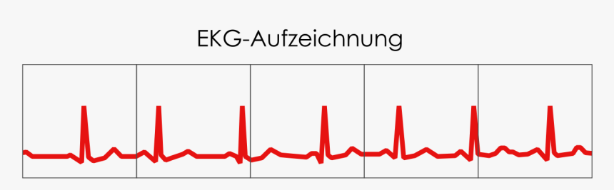 Ekg, HD Png Download, Free Download