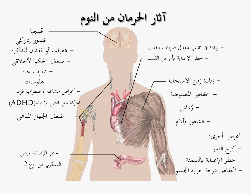 Effects Of Sleep Deprivation-ar - Effects Of Sleep Deprivation, HD Png Download, Free Download