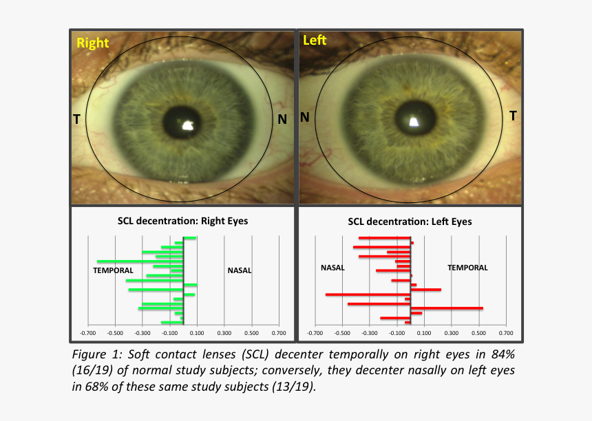 Different Between Left And Right Eye, HD Png Download, Free Download