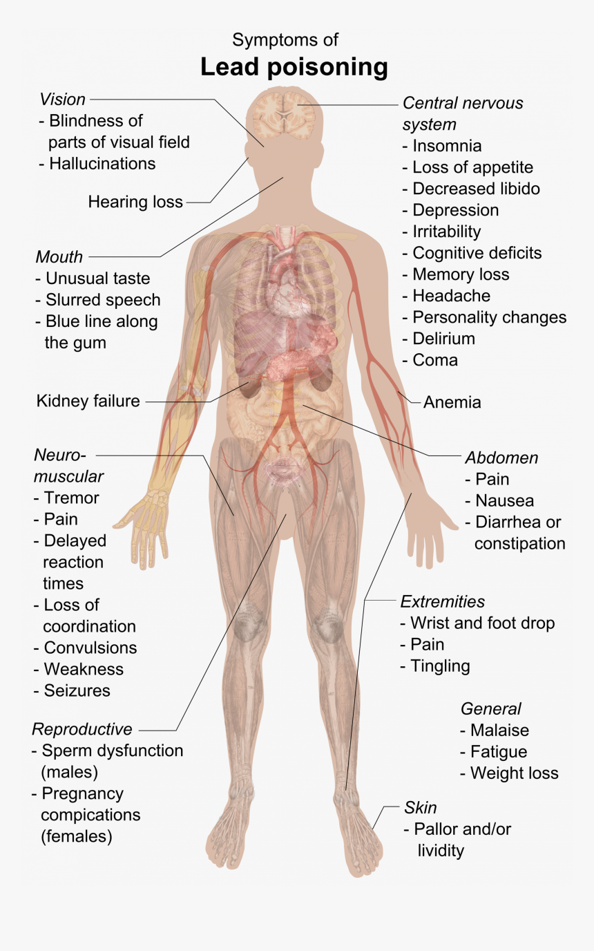 Symptoms Of Lead Poisoning - Happens If You Eat Pencil Lead, HD Png Download, Free Download