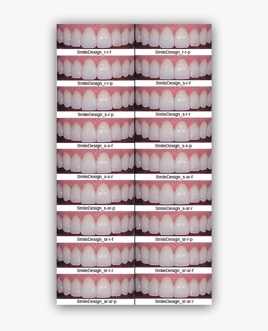 Veneers Styles, HD Png Download, Free Download