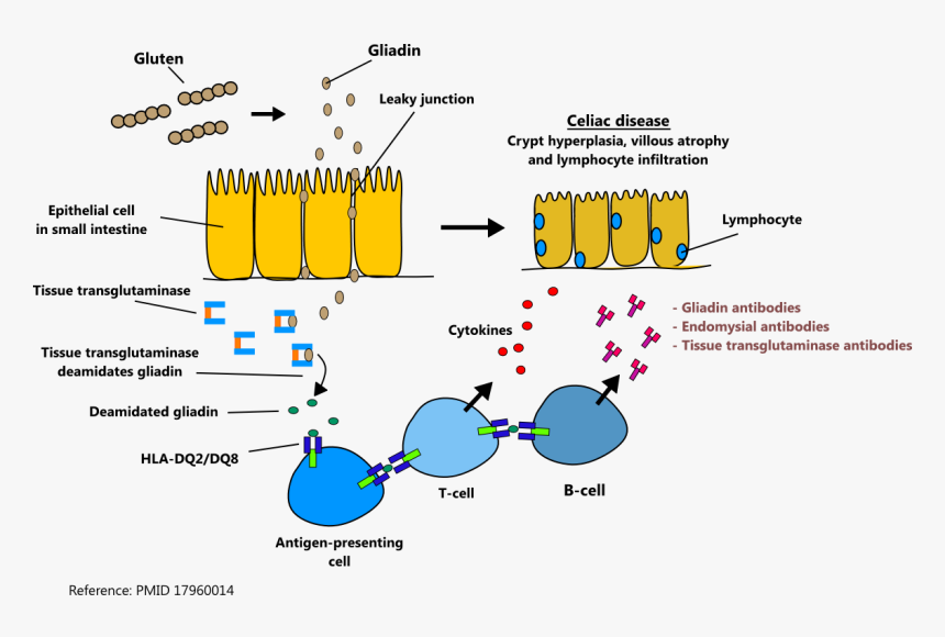 Celiac Disease Gliadin, HD Png Download, Free Download