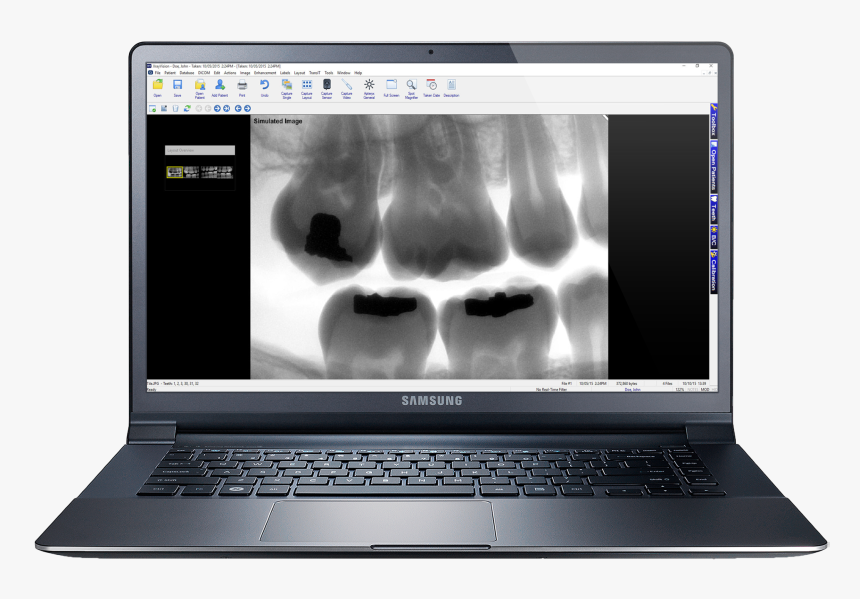 Laptop Mockup Png, Transparent Png, Free Download