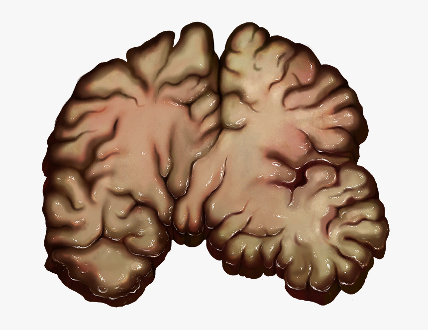 Brain - Brain (as Food), HD Png Download, Free Download