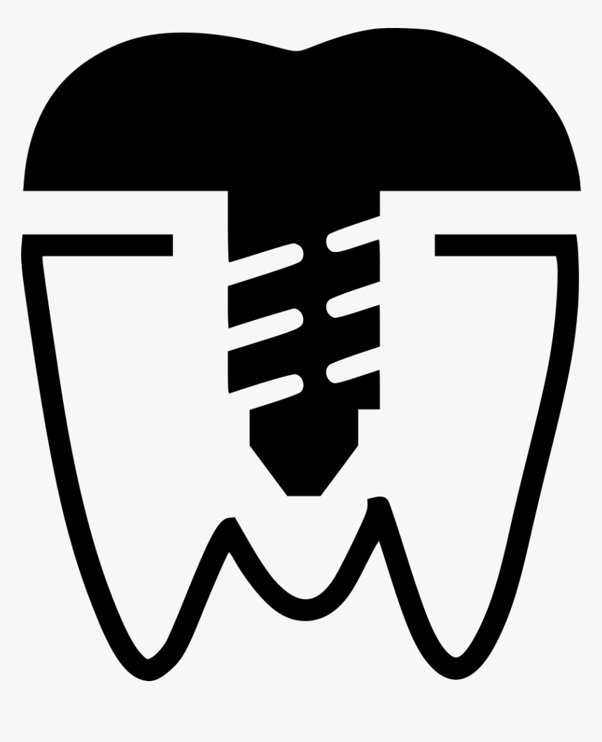 Premolar Crown Implant - Implant, HD Png Download, Free Download