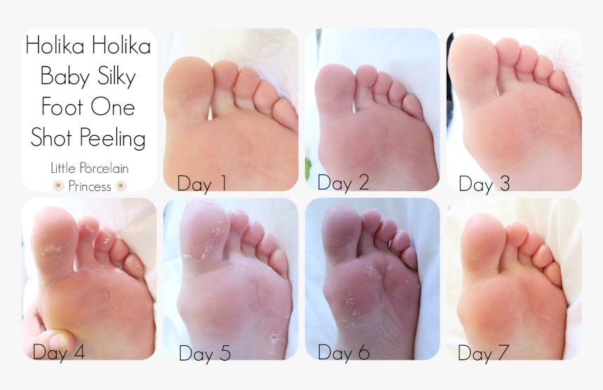 Little Porcelain Princess Fail Or Holy Grail Review - Baby Foot Peel Day 4, HD Png Download, Free Download