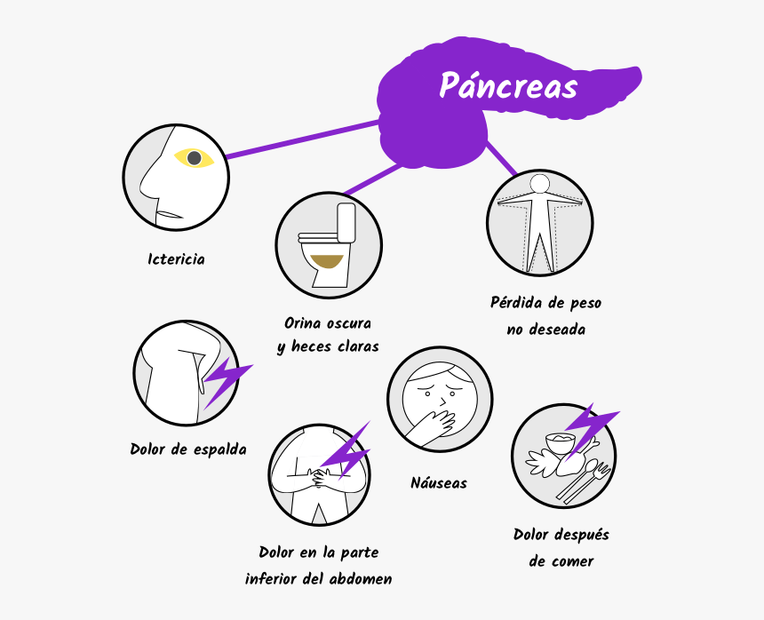 Dolor De Pancreas , Png Download - Cancer De Pancreas Sintomas, Transparent Png, Free Download