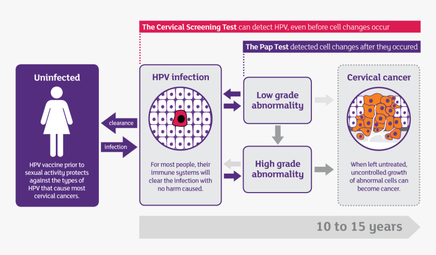 Progression Of Hpv To Cervical Cancer - Cervical Cancer Hpv Infection, HD Png Download, Free Download