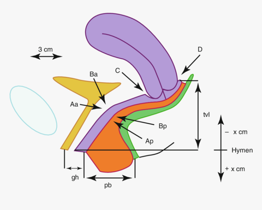 Hymen Plane, HD Png Download, Free Download