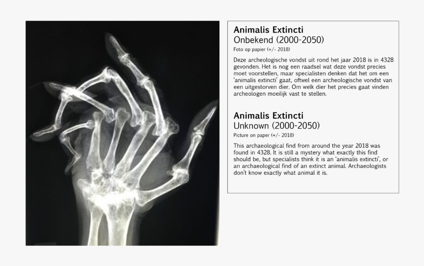 Worst Hand X Ray, HD Png Download, Free Download